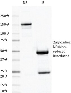 Ornithine Decarboxylase Antibody (ODC1/487), Novus Biologicals 0.2mg; Unlabeled:Antibodies,